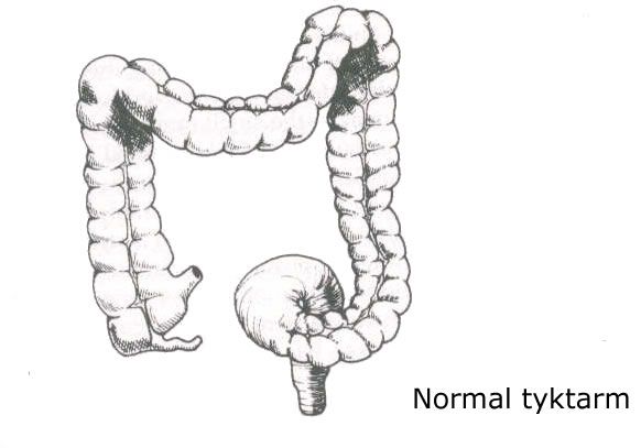 Normal tyktarm
